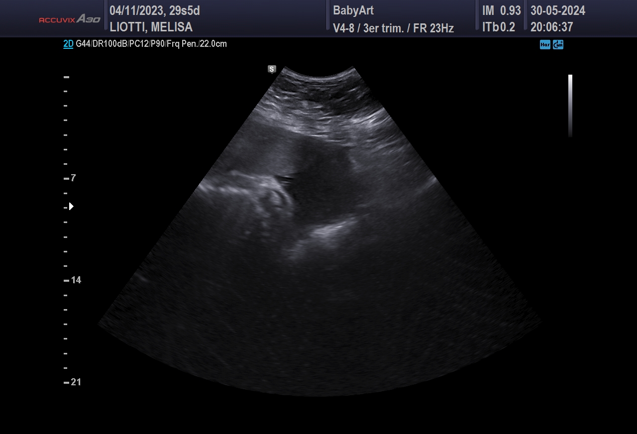 JULIA DE MELISA LIOTTI_0064.JPG